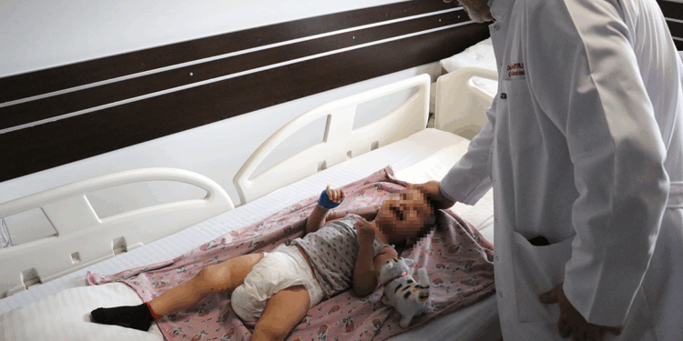 2 yaşındaki çocuğa, yanağından alınan yama ile idrar kanalı oluşturuldu