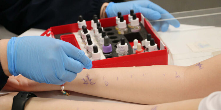 Alerjik rinit, astım hastalığına ilerleme riski taşıyor