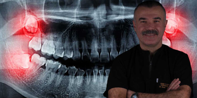 Yirmilik dişler ihmale gelmiyor