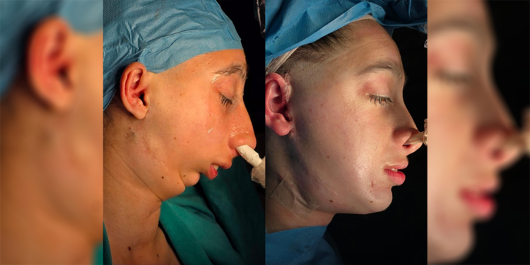 Geçirdiği kaza hayatını altüst etti, şifayı Türkiye'de buldu