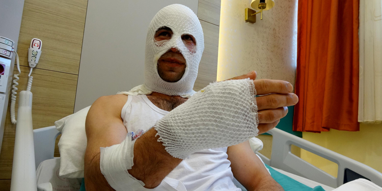 Hediye paketi hazırlarken patlayan sprey boya kutusu hastanelik etti