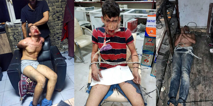 Madem işkence görmedim sanıkların telefonunda işkence fotoğraflarının ne işi var?