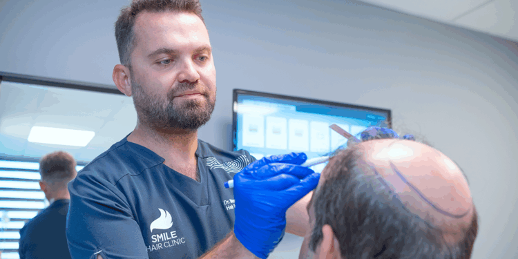 Saç dökülmesi ilerlediyse, ilaçlar etkili olmaz