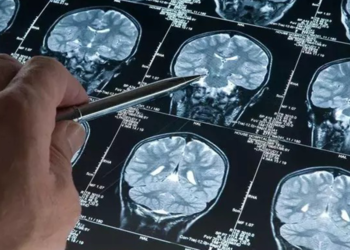 Uyku ilacı, Alzheimer ile ilişkili proteinlerin birikimini azaltabilir