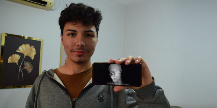 Başına isabet eden yorgun mermi nedeniyle ölüm korkusu yaşıyor