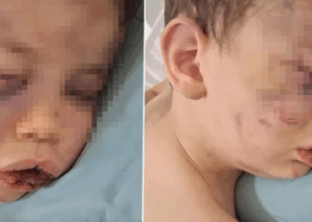 2 yaşındaki bebek annesinin sevgilisi tarafından öldüresiye dövüldü