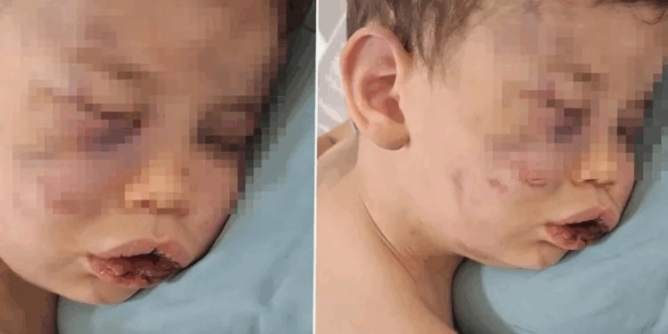 2 yaşındaki bebek annesinin sevgilisi tarafından öldüresiye dövüldü