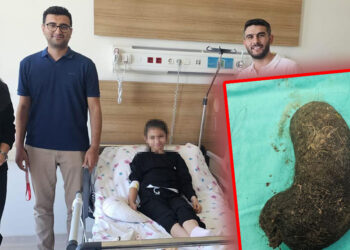 9 yaşındaki çocuğun midesinden saç yumağı çıkarıldı