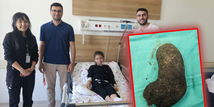 9 yaşındaki çocuğun midesinden saç yumağı çıkarıldı