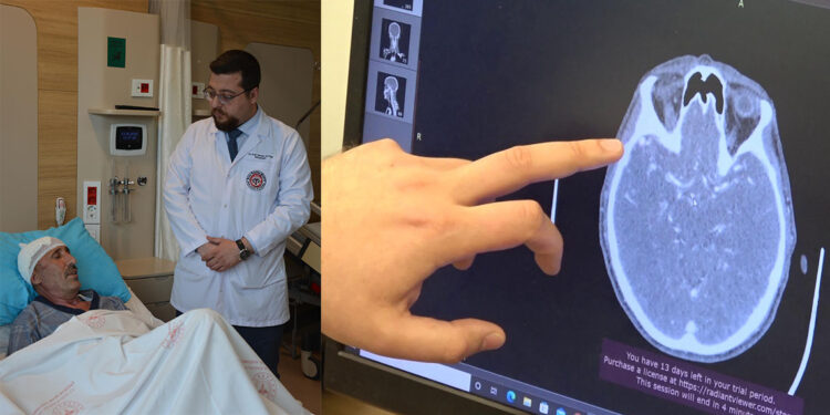 Atardamarın beyinde oluşturduğu 'damar yumağı’nı 5 saatte temizlediler