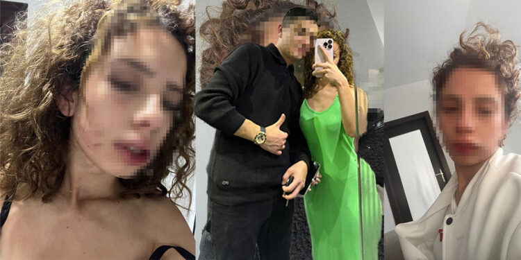 Ayrılmak isteyen sevgilisini saatlerce dövmüştü; serbest bırakıldı