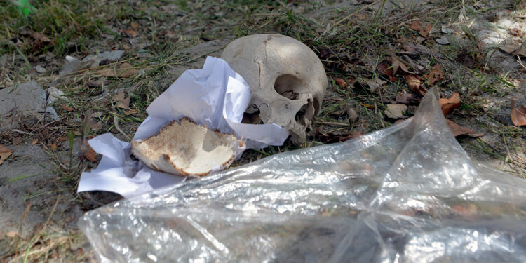 Çöpten kağıda sarılı insan kafatası çıktı