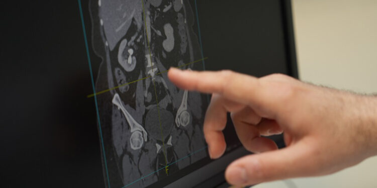 Dengeli bir diyet birçok fizyolojik mekanizmayı doğrudan etkiliyor