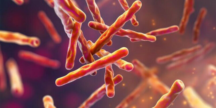 Florida'da tüberküloz vakası tespit edildi