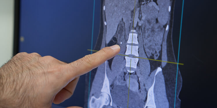 Obezite, cep telefonu, stres kısırlığın başlıca sebepleri