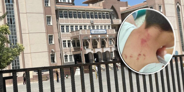 Şanlıurfa'da öğrencisini döven öğretmen tutuklandı