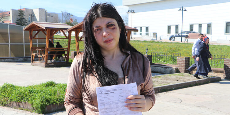 Sokak ortasında darbedilen Damla: Platinler hep yüzümde kalacakmış