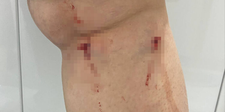 Üniversite kampüsünde köpeklerin saldırısına uğradı