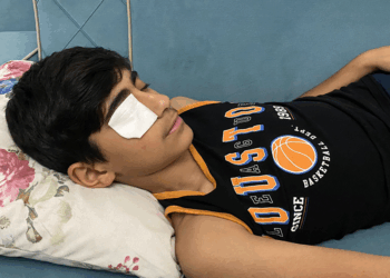 Yapıştırıcı sıçrayınca kapanan göz kapağı doktor müdahalesiyle açıldı