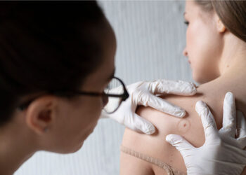 Cilt Kanseri ve melanomdan korunma yolları