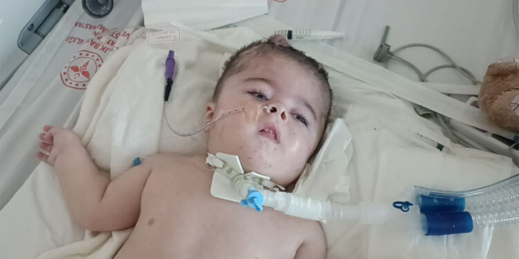 Hidrosefali hastası Ayaz, yaşam mücadelesi veriyor