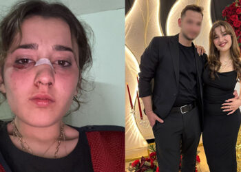 Tatil dönüş planı tartışmasında nişanlısını plajda motosiklet kaskıyla dövdü