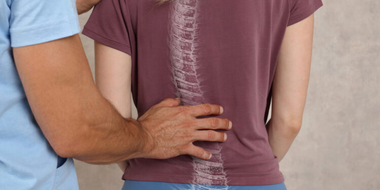 Skolyoz tedavi edilmezse kalıcı sağlık problemlerine yol açabilir