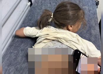 Sokak köpeklerinin saldırısına uğrayan Zeynep, yaralandı