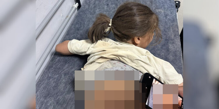 Sokak köpeklerinin saldırısına uğrayan Zeynep, yaralandı