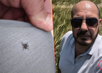 Tarlada selfi yaparken üzerinde kene olduğu fark etti