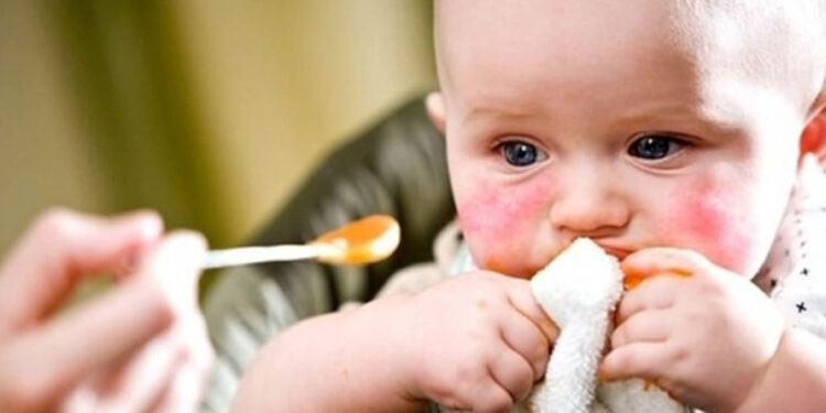 Bebeklerde besin alerjileri ciddi reaksiyonlara neden olabilir