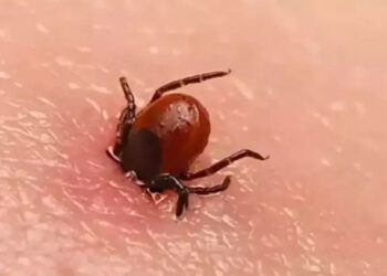 Bolu'da kenenin ısırdığı kadın öldü