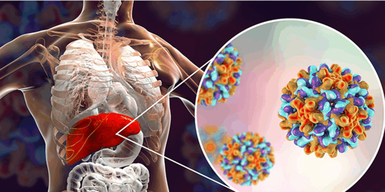 Her yıl 1,5 milyon insan hepatit nedeniyle hayatını kaybediyor