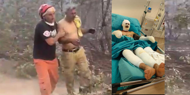 Orman yangınında ağır yaralanan orman işçisinin son hali paylaşıldı