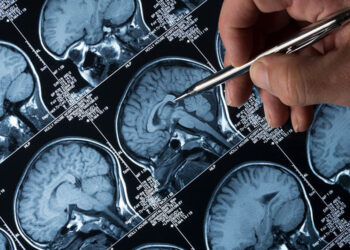 Alzheimer tedavisinde 'lityum' umudu