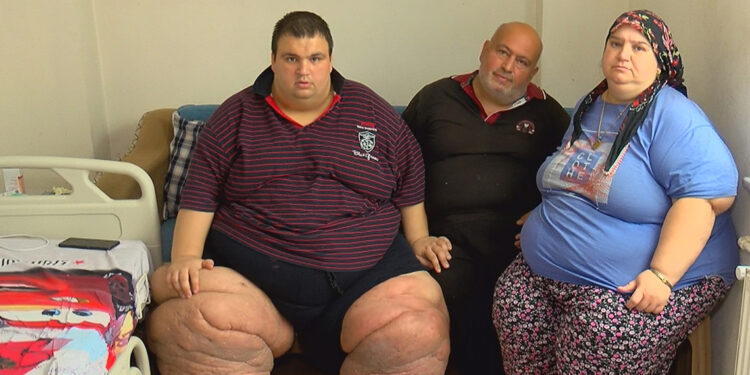 27 yaşındaki Mehmet lenfödem nedeniyle 2 yıldır hastane hastane dolaştı