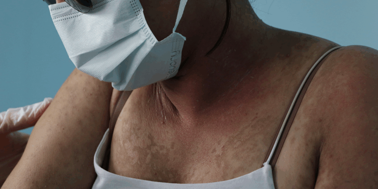 İnternetten sipariş verdiği krem hastanelik etti