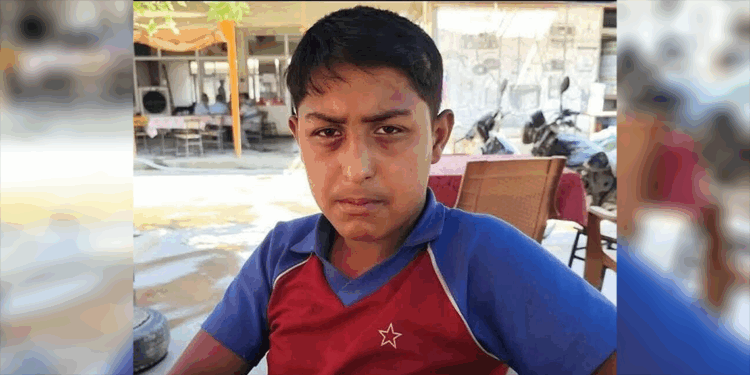 Kavgada yumruklanıp, başına sandalyeyle vurulan çocuk öldü