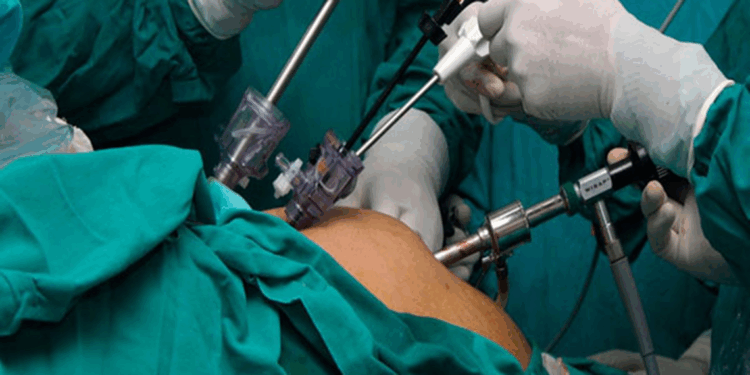 Obezite ameliyatı geçirenlerde revizyon cerrahisi girişimi yaygınlaşıyor