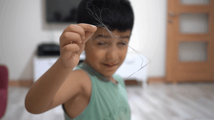 3 yıl önce vücudunda 18 santimlik kateter unutulduğu ortaya çıktı