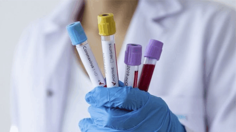 Covid-19 vakaları yeniden artışa geçti