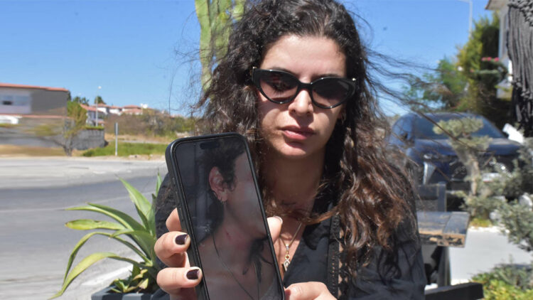 Ayrıldığı erkek arkadaşı tarafından sokak ortasında darbedildi