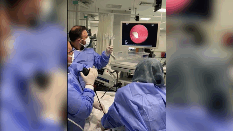 Hastanın akciğerine kaçan sarımsak operasyonla çıkarıldı