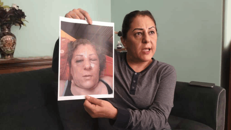 Kedi besleme kavgasında komşusunun burnunu kırdı