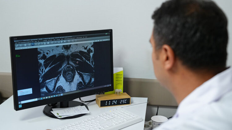 Füzyon biyopsi ile tümör odakları hedefe yönelik şekilde tespit edilebiliyor