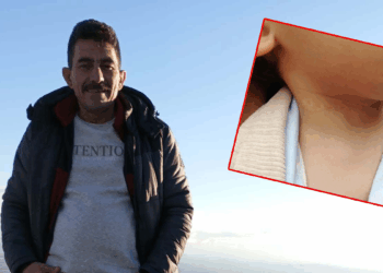 1,5 yaşındaki çocuğun boynunu kesti, evini yakmaya kalktı
