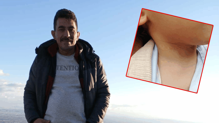 1,5 yaşındaki çocuğun boynunu kesti, evini yakmaya kalktı