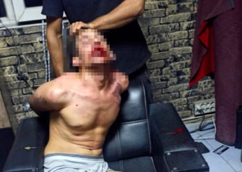 Böcek yedirip dişlerini kırdılar; 20'şer yıl hapis cezası istendi