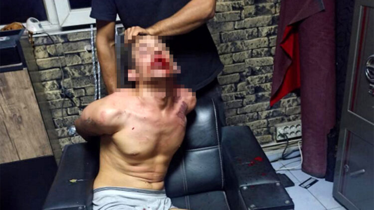 Böcek yedirip dişlerini kırdılar; 20'şer yıl hapis cezası istendi