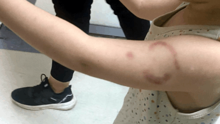 Bakımevinde 3 yaşındaki öğrencisinin kolunu ısıran öğretmen tutuklandı